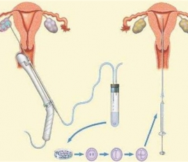 什么是孕期瘙痒